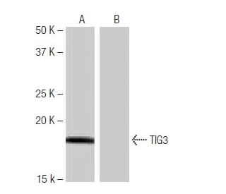TIG3 Antibody (LW-M10) - Western Blotting - Image 65072