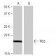 TIG3 Antibody (LW-M10) - Western Blotting - Image 65072