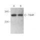 TIGAR Antibody (9C10) - Western Blotting - Image 371537
