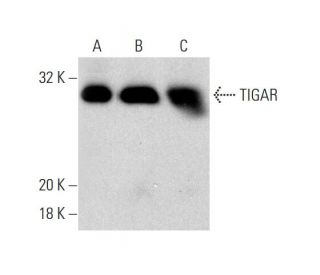 TIGAR Antibody (E-10) - Western Blotting - Image 139647 