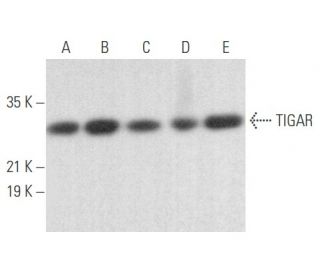 TIGAR Antibody (F-5) - Western Blotting - Image 355641 