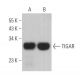 TIGAR Antibody (F-5) - Western Blotting - Image 361907