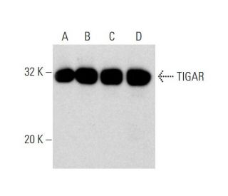 TIGAR Antibody (G-2) - Western Blotting - Image 139643 