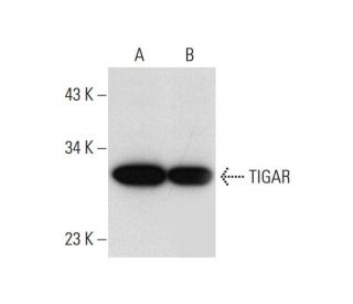 TIGAR Antibody (E-2) - Western Blotting - Image 72480