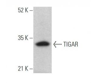TIGAR Antibody (E-2) - Western Blotting - Image 371493
