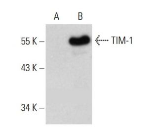 TIM-1 Antibody (A-12) - Western Blotting - Image 385349The Double Nickase Plasmid features a U6 promoter for sgRNA expression, a 20 nt targeting sequence, and a gRNA scaffold to guide Cas9n. It includes a CBh promoter for Cas9n (D10A) and puromycin resistance, GFP for transfection verification, and nuclear localization signals (NLS). The 2A peptide allows co-expression of Cas9n and Puro from a single promoter, enabling precise genome editing with reduced off-target effects.