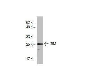 TIM Antibody (BB-7) - Western Blotting - Image 33913 
