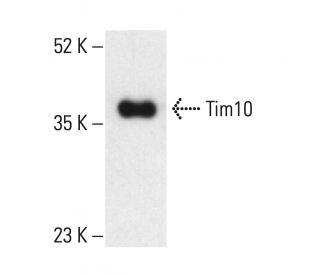 Tim10/TIMM10 Antibody (C-7) - Western Blotting - Image 404143