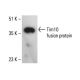 Tim10/TIMM10 Antibody (H-4) - Western Blotting - Image 411083