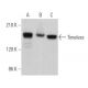 Timeless Antibody (A-3) - Western Blotting - Image 360696 