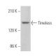 Timeless Antibody (G-4) - Western Blotting - Image 360697