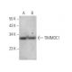 TIMMDC1 Antibody (G-10) - Western Blotting - Image 371701
