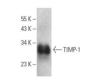 TIMP-1 Antibody (2A5) - Western Blotting - Image 3882