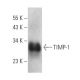 TIMP-1 Antibody (2A5) - Western Blotting - Image 3882