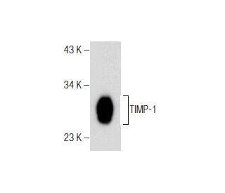 western blotting image from recommended TIMP-1 (G-6) monoclonal antibody replacement. Image 160552