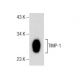 Este anticuerpo policlonal ha dejado de fabricarse. Consulta nuestro anticuerpo monoclonal recomendado <a href="timp-1-antibody-g-6">TIMP-1 (G-6)</a> (se muestran datos de muestra). western blotting image from recommended TIMP-1 (G-6) monoclonal antibody replacement. Image 160552