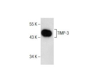 western blotting image from recommended TIMP-3 (B-2) monoclonal antibody replacement. Image 160541