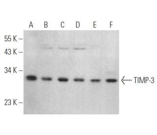 TIMP-3 Antibody (E-2) - Western Blotting - Image 375094 