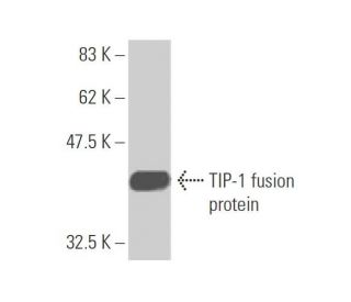 TIP-1 Antibody (1H5) - Western Blotting - Image 349576