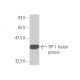 TIP-1 Antibody (1H5) - Western Blotting - Image 349576