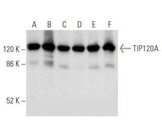 western blotting image from recommended TIP120A (G-3) monoclonal antibody replacement. Image 357355