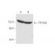 TIP120A Antibody (B-8) - Western Blotting - Image 58212 