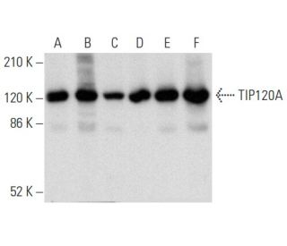 TIP120A Antibody (B-8) - Western Blotting - Image 357356 