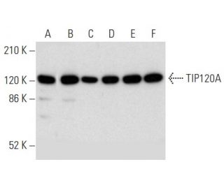 TIP120A Antibody (D-9) - Western Blotting - Image 357358