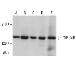 TIP120B Antibody (H-7) - Western Blotting - Image 379152 