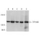 TIP120B Antibody (H-7) - Western Blotting - Image 379152 