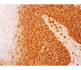 TIP60 Antibody (3F9G7) - Immunohistochemistry - Image 411719