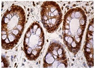 れんページ TIP60 Antibody (C-7) | SCBT - Santa Cruz Biotechnology