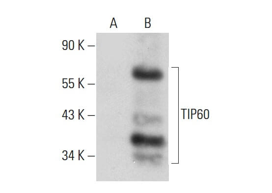 hoshi0930様 TIP60 Antibody (C-7) | SCBT - Santa Cruz Biotechnology