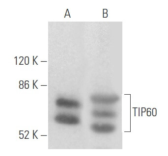 格安 (C-7) Antibody TIP60 | Biotechnology Cruz Santa - SCBT その他