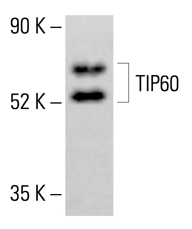 れんページ TIP60 Antibody (C-7) | SCBT - Santa Cruz Biotechnology