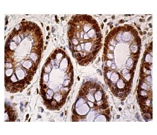 immunohistochemistry image from recommended TIP60 (C-7) monoclonal antibody replacement. Image 158894