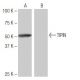 TIPIN Antibody (4C9) - Western Blotting - Image 65073