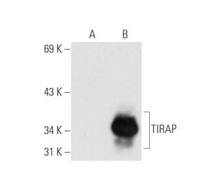 TIRAP Antibody (A-11) - Western Blotting - Image 66397