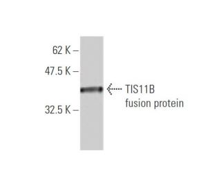 TIS11B Antibody (1A3) - Western Blotting - Image 348445The Double Nickase Plasmid features a U6 promoter for sgRNA expression, a 20 nt targeting sequence, and a gRNA scaffold to guide Cas9n. It includes a CBh promoter for Cas9n (D10A) and puromycin resistance, GFP for transfection verification, and nuclear localization signals (NLS). The 2A peptide allows co-expression of Cas9n and Puro from a single promoter, enabling precise genome editing with reduced off-target effects.