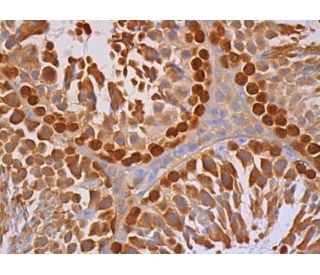 TKTL1/2 Antibody (E-8) - Immunohistochemistry - Image 386803 