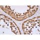 TKTL1/2 Antibody (E-8) - Immunohistochemistry - Image 386804