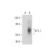 TKTL1/2 Antibody (E-8) - Western Blotting - Image 320934 