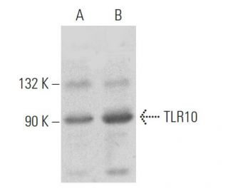 western blotting image from recommended TLR10 (2A11) monoclonal antibody replacement. Image 368593