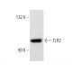 このポリクローナル抗体は販売終了となりました。弊社推奨の<a href="tlr2-antibody-tl2-1">TLR2 (TL2.1)</a>モノクローナル抗体をご覧ください(サンプルデータを表示)。 western blotting image from recommended TLR2 (TL2.1) monoclonal antibody replacement. Image 32738