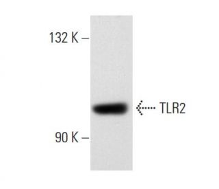 western blotting image from recommended TLR2 (TL2.1) monoclonal antibody replacement. Image 32738