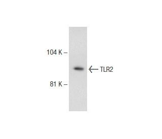 western blotting image from recommended TLR2 (TL2.3) monoclonal antibody replacement. Image 145754