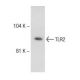Este anticorpo policlonal foi descontinuado. Consulta o nosso anticorpo monoclonal <a href="tlr2-antibody-tlr2-3">TLR2 (TL2.3)</a> recomendado (dados de amostra apresentados). western blotting image from recommended TLR2 (TL2.3) monoclonal antibody replacement. Image 145754