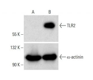 TLR2 CRISPR Activation Plasmid (h): sc-400267-ACT. Western blot analysis of TLR2 expression in non-transfected control (A) 