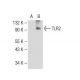 TLR2 (A-9): sc-166900. Western blot analysis of TLR2 expression in...