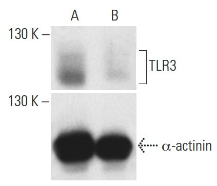 TLR3 siRNA h shRNA and Lentiviral Particle Gene Silencers